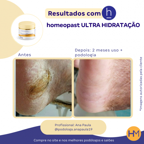 Ultra Hidratação